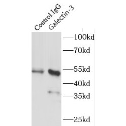 Galectin 3 (LGALS3) Antibody