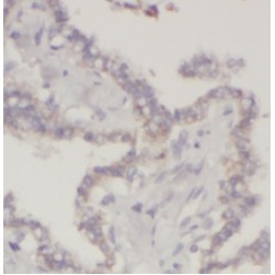 Galectin 3 (LGALS3) Antibody