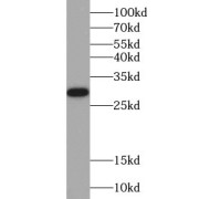 WB analysis of HeLa cells, using Galectin 3 antibody (1/1000 dilution).