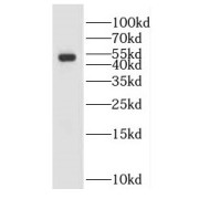 WB analysis of HL-60 cells, using GALK2 antibody (1/500 dilution).