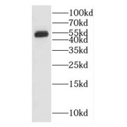 WB analysis of human liver tissue, using GALNS antibody (1/400 dilution).