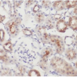 Polypeptide N-Acetylgalactosaminyltransferase 14 (GALNT14) Antibody