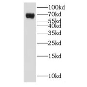 WB analysis of mouse testis tissue, using GALNT14 antibody (1/400 dilution).