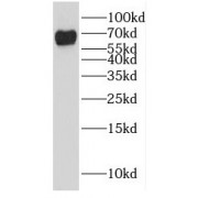WB analysis of HeLa cells, using GALNT4 antibody (1/800 dilution).