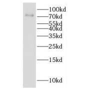 WB analysis of HeLa cells, using GALNT7 antibody (1/800 dilution).