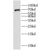 WB analysis of mouse brain tissue, using GALNT9 antibody (1/1000 dilution).