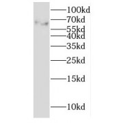 WB analysis of HEK-293 cells, using GALNTL2 antibody (1/200 dilution).