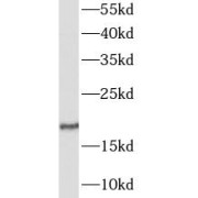 WB analysis of U-87MG cells, using GALP antibody (1/1000 dilution).