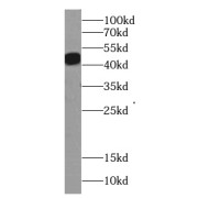 WB analysis of HeLa cells, using gamma Actin antibody (1/500 dilution).