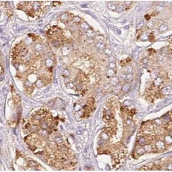 Guanidinoacetate N-Methyltransferase (GAMT) Antibody