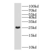 WB analysis of mouse liver tissue, using GAMT antibody (1/6000 dilution).