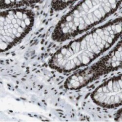 H/ACA Ribonucleoprotein Complex Subunit 1 (GAR1) Antibody