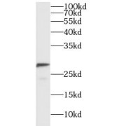 WB analysis of A375 cells, using GAR1 antibody (1/500 dilution).