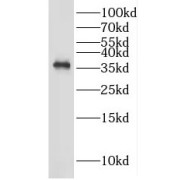 WB analysis of SH-SY5Y cells, using GAS1 antibody (1/300 dilution).