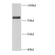 WB analysis of DU 145 cells, using GAS6 antibody (1/1000 dilution).