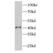 WB analysis of HepG2 cells, using GATA5 antibody (1/300 dilution).