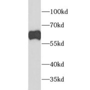 WB analysis of MCF-7 cells, using GATA6 antibody (1/1000 dilution).