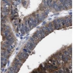 Guanylate Binding Protein 1 (GBP1) Antibody