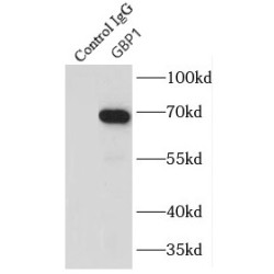 Guanylate Binding Protein 1 (GBP1) Antibody