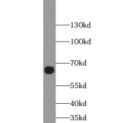 WB analysis of HUVEC cells, using GBP1 antibody (1/1500 dilution).