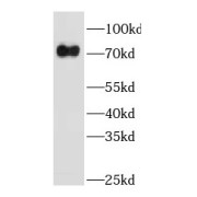 WB analysis of human placenta tissue, using GBP4 antibody (1/600 dilution).