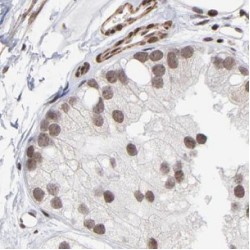 Guanylate Binding Protein 5 (GBP5) Antibody