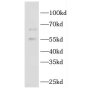 WB analysis of U-937 cells, using GBP5 antibody (1/1500 dilution).