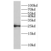 WB analysis of Raji cells, using GCET2 antibody (1/300 dilution).