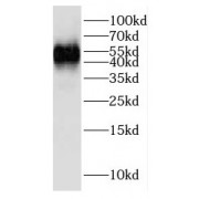 WB analysis of mouse liver tissue, using GCK antibody (1/600 dilution).