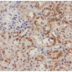 Gamma-Glutamylcysteine Synthetase (GCLC) Antibody