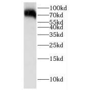 WB analysis of Jurkat cells, using GCLC antibody (1/2000 dilution).