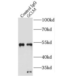 Glutamate Cysteine Ligase, Modifier Subunit (GCLM) Antibody