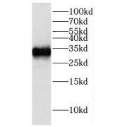 WB analysis of A431 cells, using GCLM antibody (1/500 dilution).