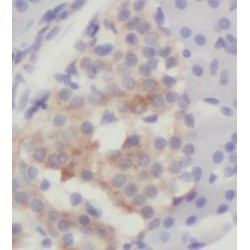 Granulocyte Colony Stimulating Factor (G-CSF) Antibody