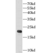 WB analysis of Transfected HEK-293 cells, using G-CSF antibody (1/1000 dilution).