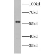 WB analysis of Raji cells, using GDAP2 antibody (1/1000 dilution).