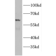 WB analysis of PC-3 cells, using GDE1 antibody (1/500 dilution).