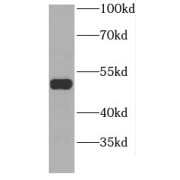 WB analysis of HepG2 cells, using GDI2 antibody (1/300 dilution).