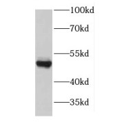 WB analysis of HepG2 cells, using GDI2 antibody (1/300 dilution).