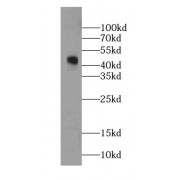 WB analysis of HepG2 cells, using GDI2 antibody (1/1000 dilution).
