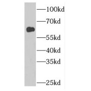 WB analysis of mouse skin tissue, using GDPD2 antibody (1/600 dilution).