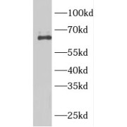 WB analysis of Mouse skeletal muscle tissue, using ARHGEF25/GEFT antibody (1/1500 dilution).