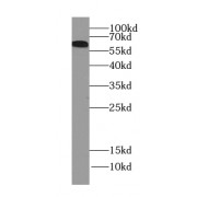 WB analysis of mouse skeletal muscle tissue, using ARHGEF25/GEFT-Specific antibody (1/1500 dilution).