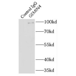 Gem Associated Protein 4 (GEMIN4) Antibody