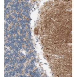 Gem Associated Protein 5 (GEMIN5) Antibody