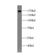 WB analysis of Jurkat cells, using GEMIN5 antibody (1/1500 dilution).