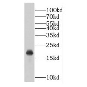 WB analysis of HEK-293 cells, using GEMIN6 antibody (1/300 dilution).