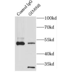 Gem Associated Protein 8 (GEMIN8) Antibody