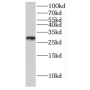 WB analysis of human testis tissue, using GMNN antibody (1/300 dilution).