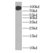 WB analysis of human brain tissue, using gephyrin antibody (1/400 dilution).